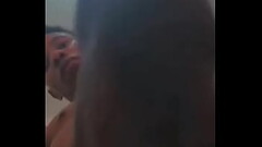R3almelanin Thumb
