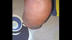 Myanmar gay Cocklovermlm  homemade saline injection Thumb