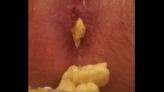 asshole ( 18) eat banana. Thumb