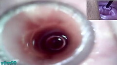 Lesbians Extreme Cervix Play and Peehole Fucking Penis Dildo Thumb