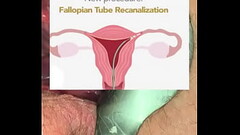 Deepest gyno play ever Thumb