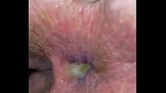 Nasty anal creampie for wife Thumb