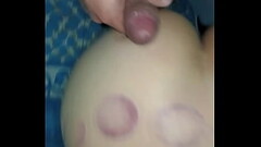 Termina la sesi&oacute_n de terapia me veng&oacute_ en su pierna Thumb