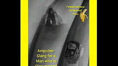 Amputee porn Thumb