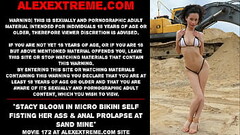 Stacy Bloom in micro bikini self fisting her ass &amp_ anal prolapse at sand mine Thumb